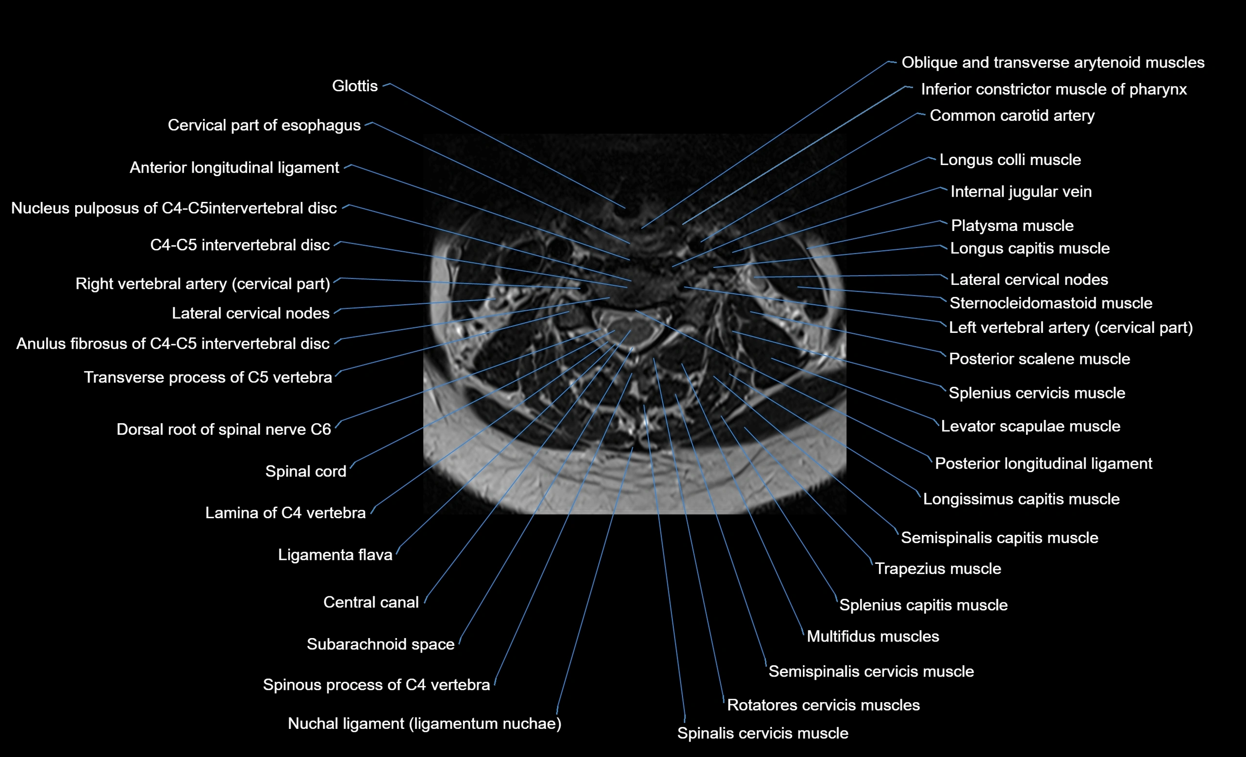 cervical spine cross sectional MRI anatomy  3T MRI axial  image-img-00001-00025.webp